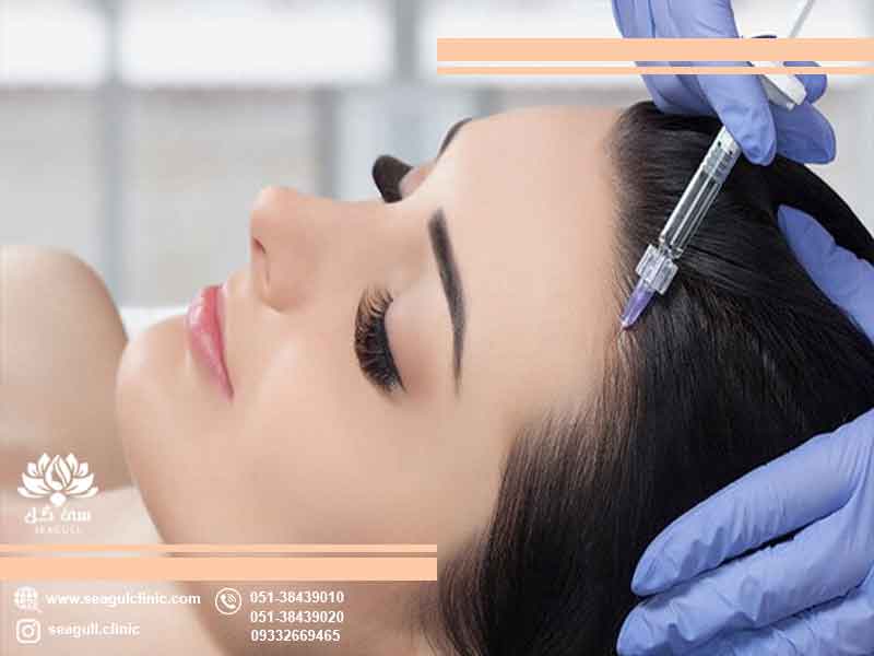 قیمت و هزینه مزوتراپی مو در سال 1404 چقدر است؟ | 093322669265