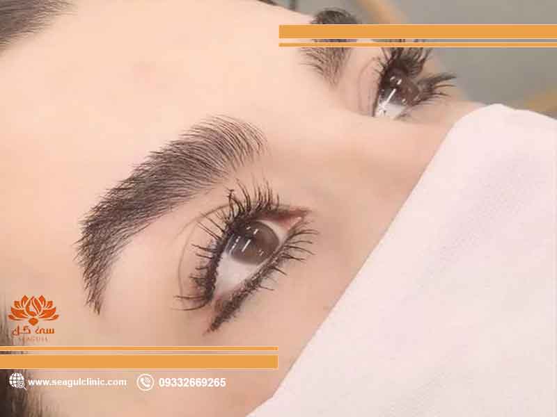 جوانسازی پوست در کلینیک تخصصی مشهد | 09332669265