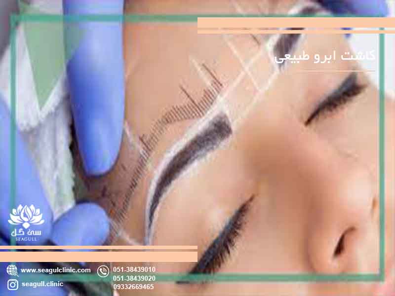 هزینه کاشت ابرو طبیعی مشهد | دکتر اشرفی